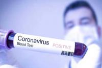 Ilustrasi : Virus COVID19