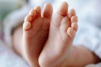 Bayi Kembar Siam Berbadan Satu Berkepala Dua Meninggal Dunia