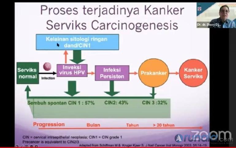 Tangkapan layar narasumber Dr dr Dovy Djanas SpOG KFM MARS saat webinar. (Foto : Fajril)