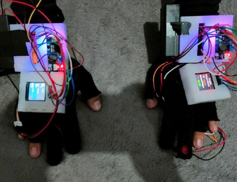 Vitaligse, prototipe inovatif yang dapat membantu dalam pencegahan penyakit jantung koroner. (Dok : Istimewa)