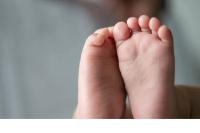 Bayi Adnan Arfandi Didiagnosa Kemungkinan Teratoma