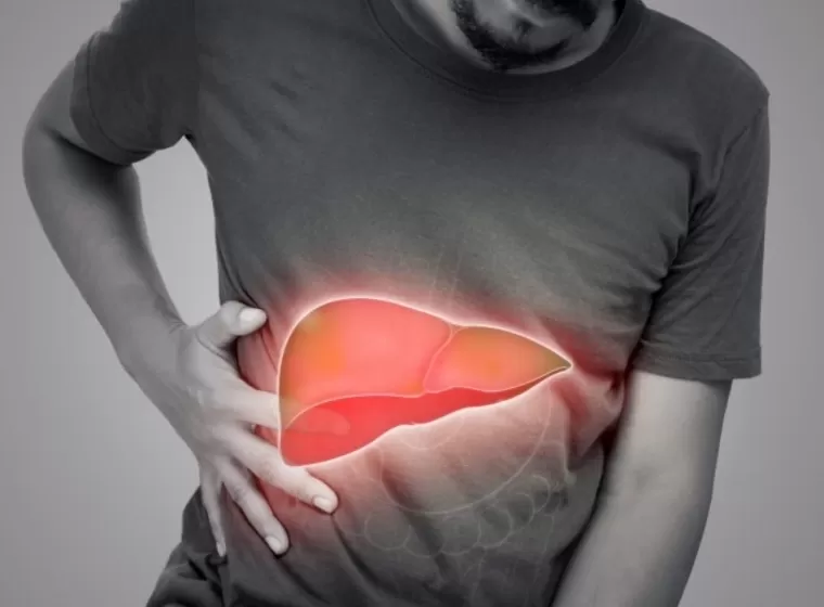 Ilustrasi hepatitis. IST