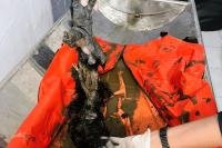 Geger Temuan Potongan Kaki Misterius di Solok, Hasil Pemeriksaan Ungkap Fakta Mengejutkan!